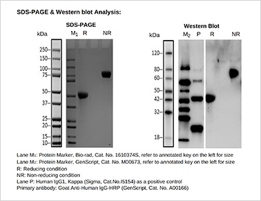 SDS-PAGE & Western blot analysis SDS-PAGE & Western blot analysis